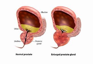 ProstaBiome support prostate health